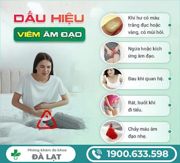 Hình ảnh minh họa